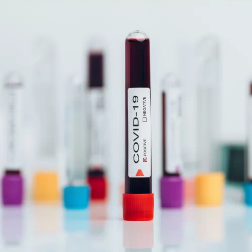 Muestra de laboratorio de la novela Coronavirus